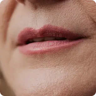 Aumento de labios