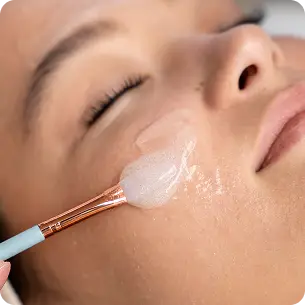 Peeling químico