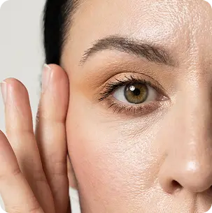 Relleno de ojeras