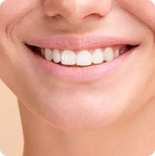 Sonrisa gingival