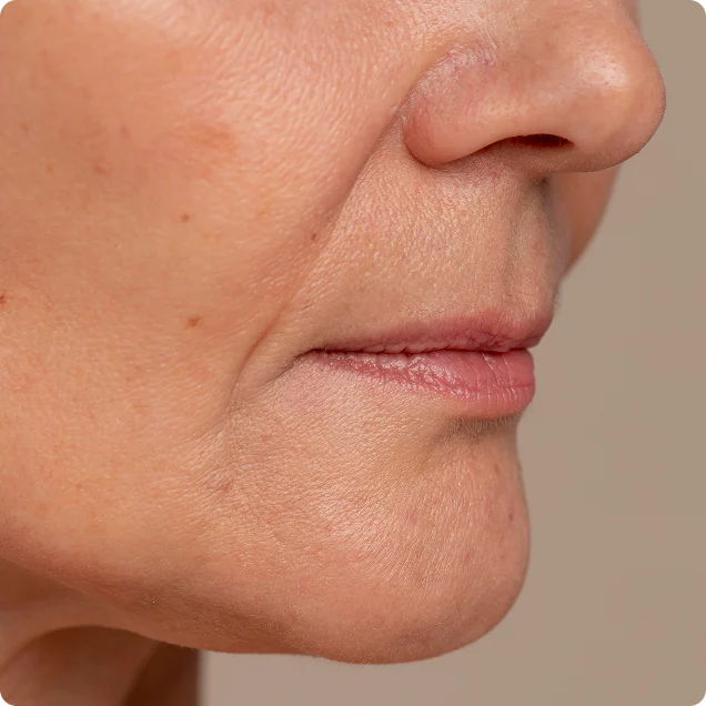 clinica lineas marioneta