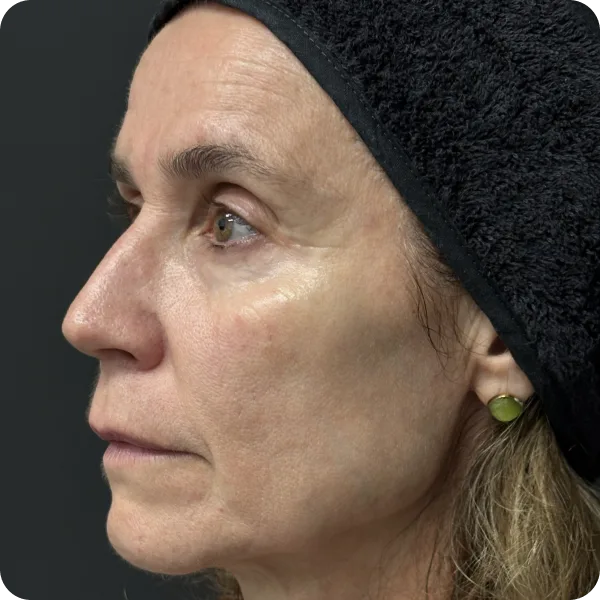 skin reset orobal las palmas gran canaria