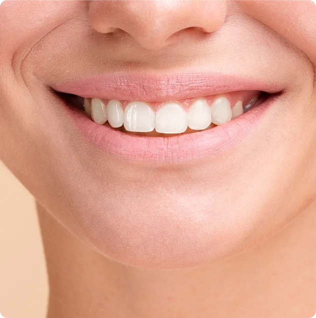 sonrisa gingival las palmas